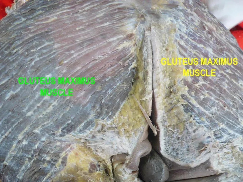 Fotografia preparatu anatomicznego: Mięsień pośladkowy wielki