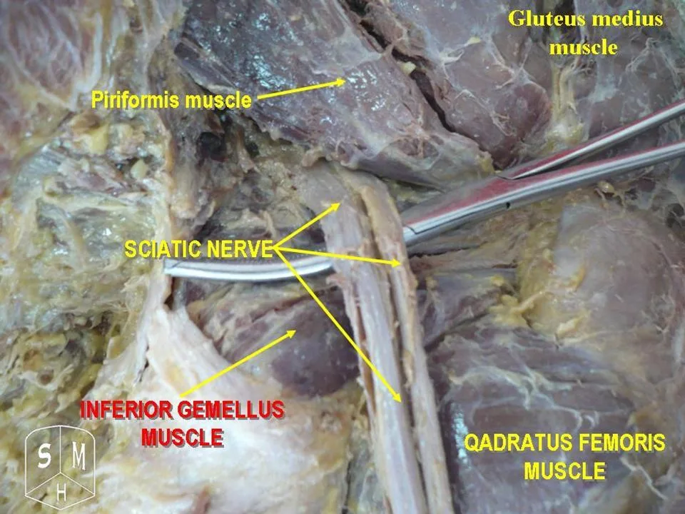 Fotografia preparatu anatomicznego: Mięsień pośladkowy średni