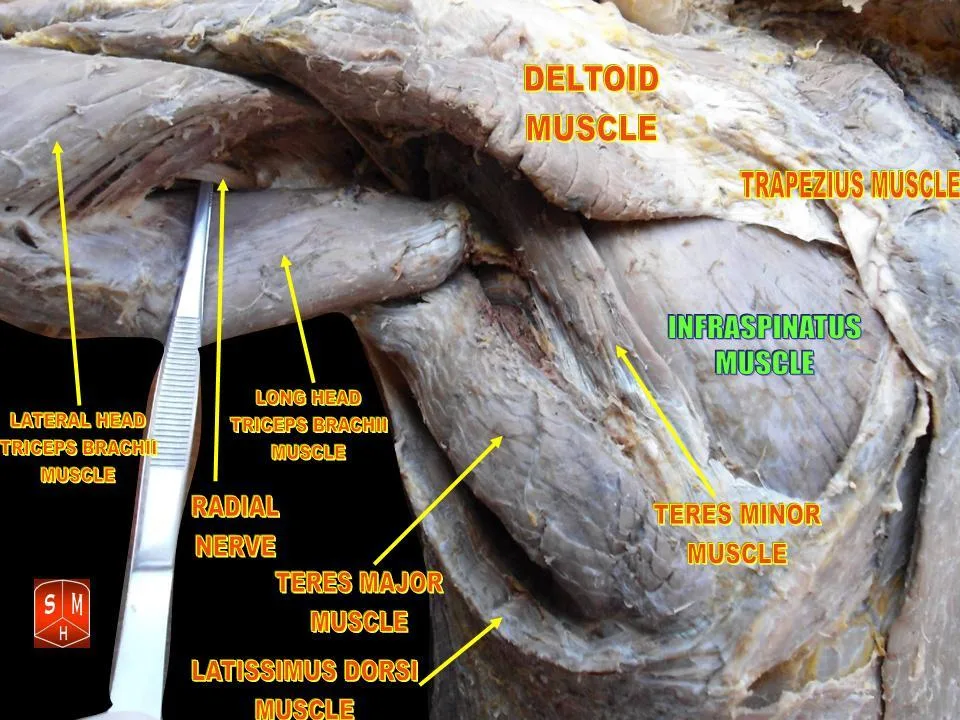 Fotografia preparatu anatomicznego: Mięsień podgrzebieniowy