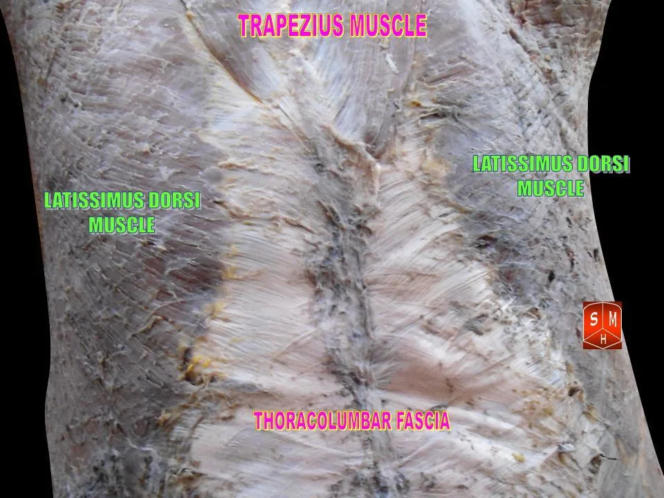 Fotografia preparatu anatomicznego: Mięsień najszerszy grzbietu