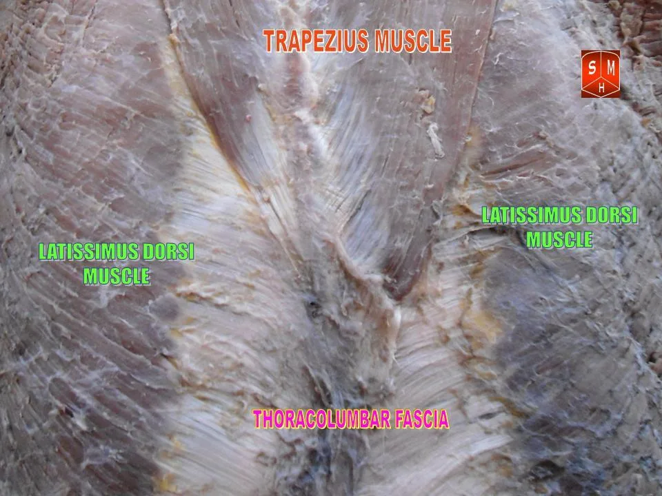 Fotografia preparatu anatomicznego: Mięsień najszerszy grzbietu