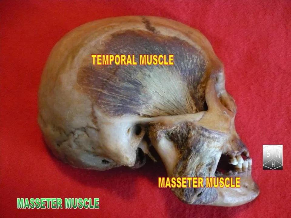 Fotografia preparatu anatomicznego: Mięsień żwacz