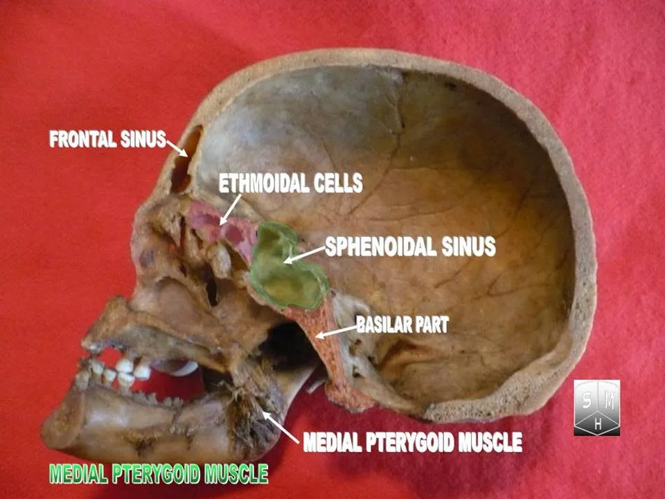 Fotografia preparatu anatomicznego: Mięsień skrzydłowy przyśrodkowy