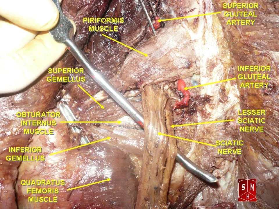 Fotografia preparatu anatomicznego: Mięsień gruszkowaty