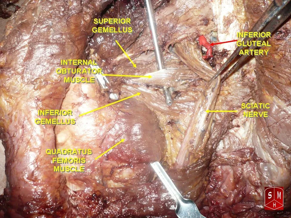 Fotografia preparatu anatomicznego: Mięsień czworoboczny uda