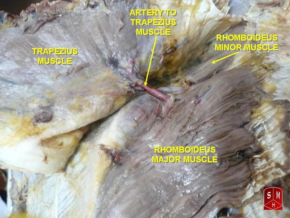 Fotografia preparatu anatomicznego: Mięsień równoległoboczny większy