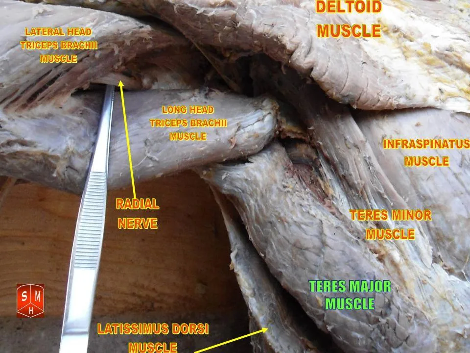 Fotografia preparatu anatomicznego: Mięsień obły większy