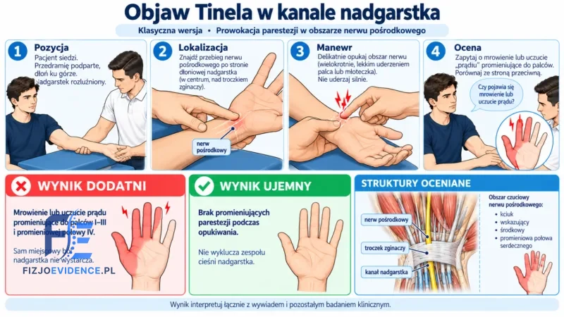 Objaw Tinela w kanale nadgarstka