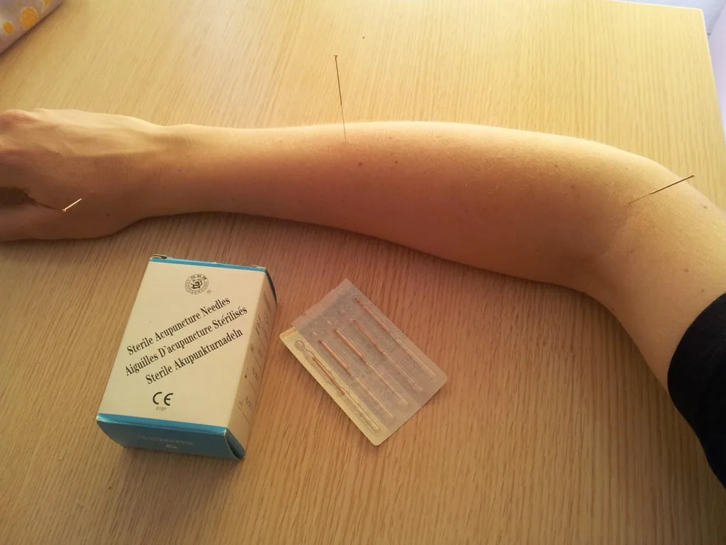 Przedramię z cienkimi igłami oraz opakowanie i przezroczysta tacka z igłami na drewnianym blacie.